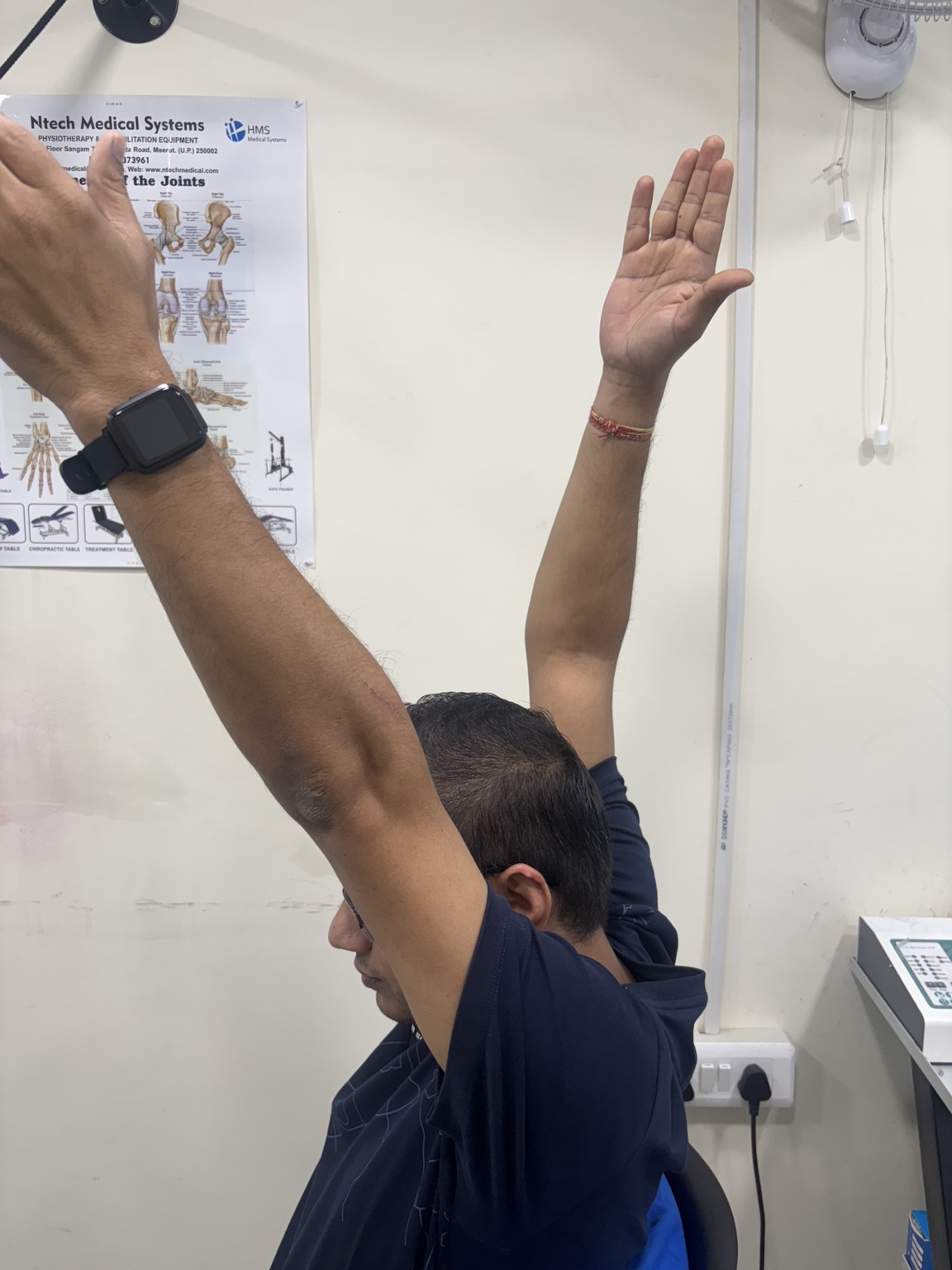 Upper-limb mobility exercise